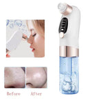 Aqua Vacuum Pore Cleaner | Mini Hydra Facial Device